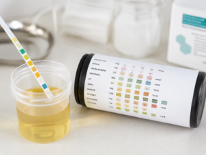 Bandelette urinaire multiparamètre trempée dans un échantillon d'urine avec échelle colorimétrique de lecture